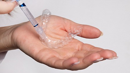 Hands applying whitening gel to custom-fitted applicator tray