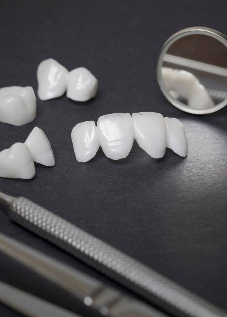 Several white dental crowns and veneers on table