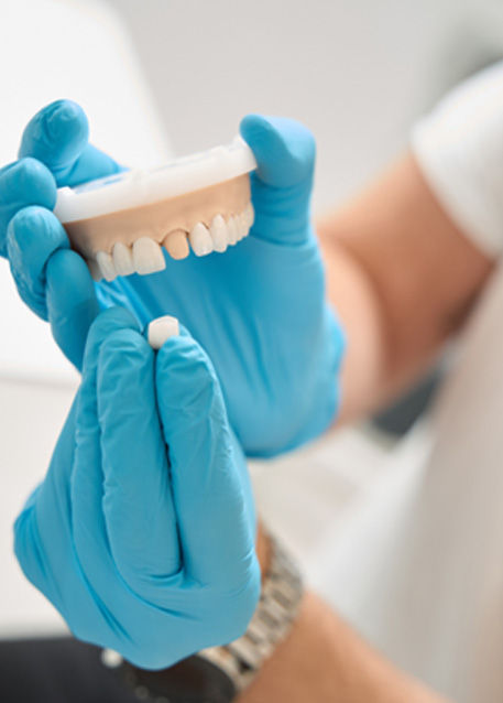 Dentist holding mouth mold and discussing cost of dental crowns in Tampa