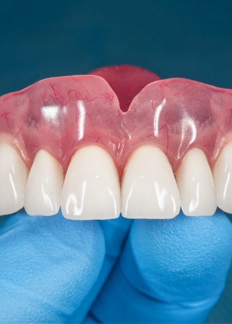 Gloved hand holding a denture