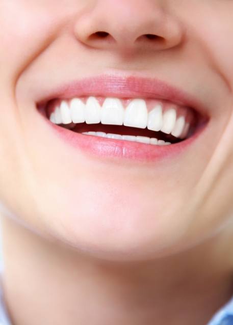 Close up of person smiling with straight white teeth