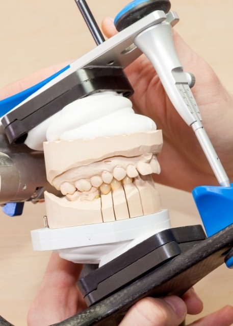 Dentist holding a model of the teeth in an adjustment device