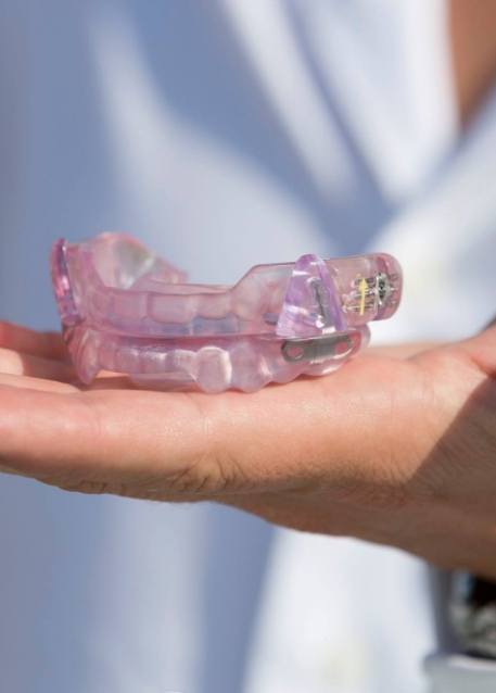 Dentist holding a light purple occlusal splint tray