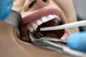 Dentist working on patient. 