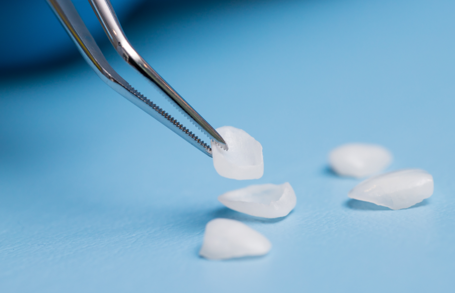 Close up of veneers on forceps